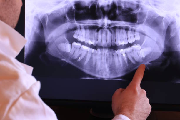 Best Broken or Chipped Tooth Repair in Manti, UT